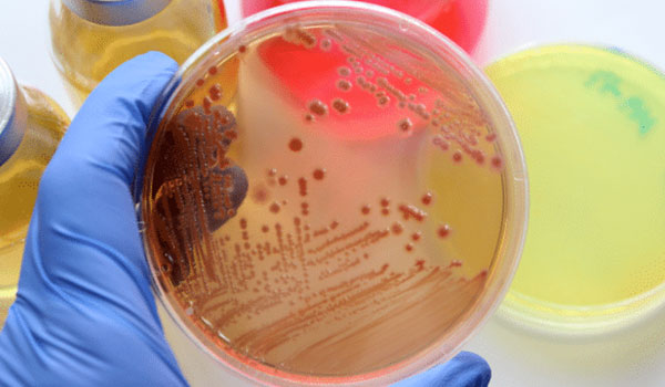 Microbiología Básica de Alimentos